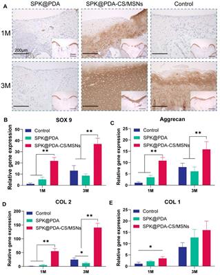 Porous Bioactive Prosthesis With Chitosan/Mesoporous Silica Nanoparticles Microspheres Sequentially and Sustainedly Releasing Platelet-Derived Growth Factor-BB and Kartogenin: A New Treatment Strategy for Osteoarticular Lesions